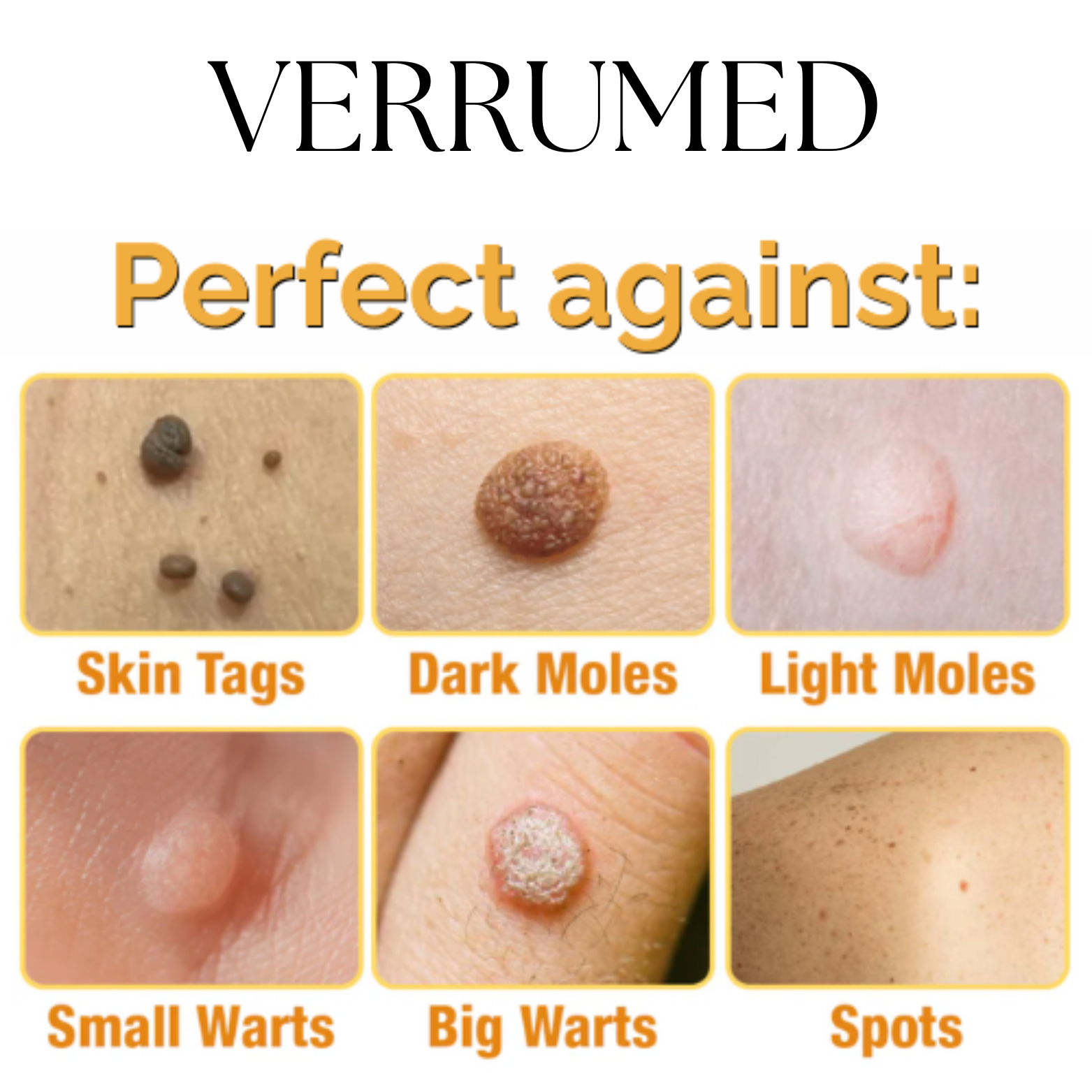 VERRUMED-1.png